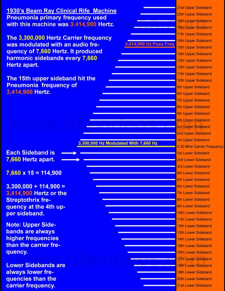 Pneumonia Sideband Chart